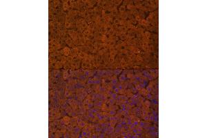 Immunofluorescence analysis of Rat liver using UGT1 antibody (ABIN6132769, ABIN6149895, ABIN6149896 and ABIN6221779) at dilution of 1:100.