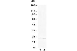 Western blot testing of Bcl-XS antibody and Lane 1:  HeLa (Bcl-X/s (AA 120-130) 抗体)