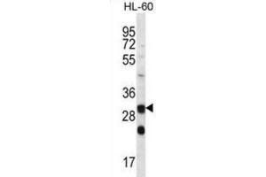 Western Blotting (WB) image for anti-Carbonic Anhydrase VI (CA6) antibody (ABIN2996883) (CA6 抗体)