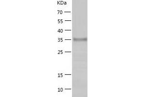 Western Blotting (WB) image for Receptor Tyrosine Kinase-Like Orphan Receptor 1 (ROR1) (AA 30-406) protein (His tag) (ABIN7124800)
