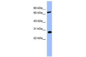 COMT antibody used at 1 ug/ml to detect target protein. (COMT 抗体  (Middle Region))