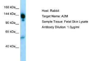 Host: RabbitTarget Name: A2MAntibody Dilution: 1. (alpha 2 Macroglobulin 抗体  (N-Term))