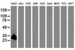 Image no. 1 for anti-Sulfotransferase Family, Cytosolic, 1A, Phenol-Preferring, Member 1 (SULT1A1) antibody (ABIN1501227) (SULT1A1 抗体)