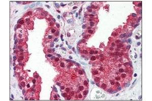 Immunohistochemistry (IHC) image for anti-Folate Hydrolase (Prostate-Specific Membrane Antigen) 1 (FOLH1) (AA 117-351) antibody (ABIN317554) (PSMA 抗体  (AA 117-351))