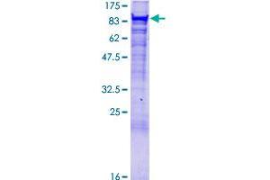 VPS35 Protein (AA 1-796) (GST tag)