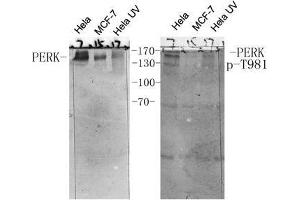 Western Blot (WB) analysis of specific cells using antibody diluted at 1:1000. (PERK 抗体  (pThr981))