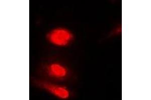 Immunofluorescent analysis of Annexin A11 staining in Jurkat cells. (Annexin A11 抗体)