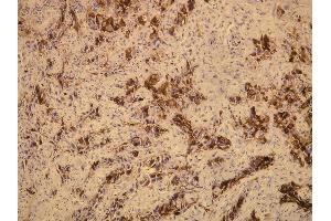 Immunohistochemistry (IHC) image for anti-Mucin 1 (MUC1) (C-Term) antibody (ABIN870416) (MUC1 抗体  (C-Term))