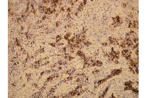 Immunohistochemistry (IHC) image for anti-Mucin 1 (MUC1) (C-Term) antibody (ABIN870418) (MUC1 抗体  (C-Term))