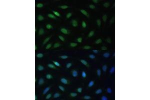 Immunofluorescence analysis of U-2 OS cells using LBR Polyclonal Antibody (ABIN6128194, ABIN6143105, ABIN6143106 and ABIN6221130) at dilution of 1:100 (40x lens). (Lamin B Receptor 抗体  (AA 1-211))