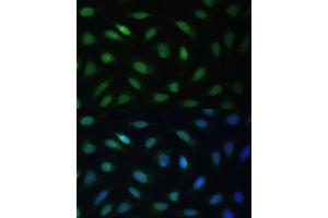 Immunofluorescence analysis of U-2 OS cells using LBR Polyclonal Antibody (ABIN6128194, ABIN6143105, ABIN6143106 and ABIN6221130) at dilution of 1:100 (40x lens). (Lamin B Receptor 抗体  (AA 1-211))