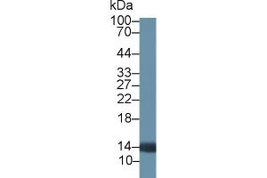Detection of PTK6 in Rat Prostate lysate using Polyclonal Antibody to Protein Tyrosine Kinase 6 (PTK6) (PTK6 抗体  (AA 191-445))
