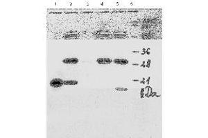 Western Blotting (WB) image for anti-Human Papilloma Virus 18 E7 (HPV-18 E7) (AA 1-35), (N-Term) antibody (ABIN781779) (HPV18 E7 抗体  (N-Term))