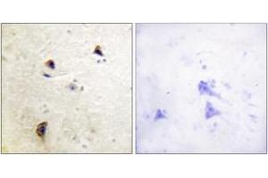 Immunohistochemistry analysis of paraffin-embedded human brain, using Rabphilin 3A (Phospho-Ser237) Antibody. (RPH3A 抗体  (pSer237))