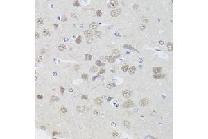 Immunohistochemistry of paraffin-embedded rat brain using PPP1CC antibody (ABIN5972199) at dilution of 1/100 (40x lens). (PPP1CC 抗体)