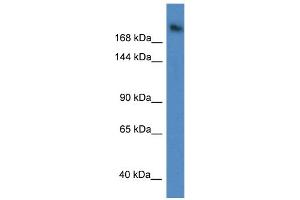 WB Suggested Anti-WDR87 Antibody Titration: 1. (WDR87 抗体  (C-Term))
