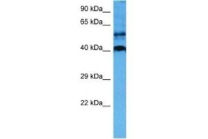 Western Blotting (WB) image for anti-SRY (Sex Determining Region Y)-Box 18 (SOX18) (Middle Region) antibody (ABIN2777725)
