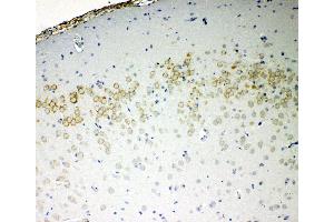 Anti-VE Cadherin antibody, IHC(P) IHC(P): Rat Brain Tissue (Cadherin 5 抗体  (C-Term))