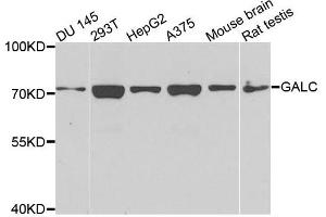 Western blot analysis of extracts of various cells, using GALC antibody. (GALC 抗体)