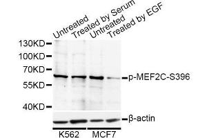 Western blot analysis of extracts of K-562 and MCF-7 cells, using Phospho-MEF2C-S396 antibody. (MEF2C 抗体  (pSer396))