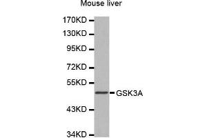 Western Blotting (WB) image for anti-Glycogen Synthase Kinase 3 alpha (GSK3a) (AA 409-483) antibody (ABIN1680131) (GSK3 alpha 抗体  (AA 409-483))