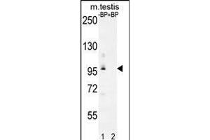 Western blot analysis of PDPR Antibody Pab pre-incubated without(lane 1) and with(lane 2) blocking peptide in mouse testis tissue lysate (PDP 抗体  (C-Term))