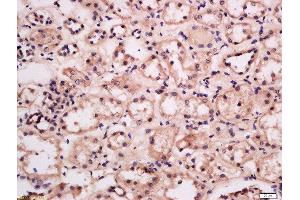 Formalin-fixed and paraffin embedded human kidney labeled with Anti-GRB10/14 Polyclonal Antibody, Unconjugated  at 1:300 followed by conjugation to the secondary antibody and DAB staining. (GRB10/14 (AA 501-594) 抗体)