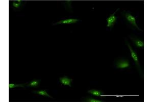 Immunofluorescence of monoclonal antibody to HEXIM1 on HeLa cell. (HEXIM1 抗体  (AA 1-359))