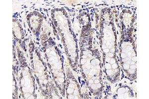 Immunohistochemistry analysis of paraffin-embedded rat stomach node using MGMT Polyclonal Antibody at dilution of 1:300. (MGMT 抗体)