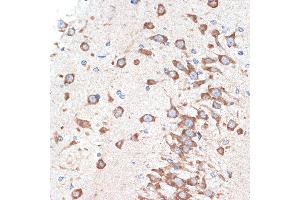 Immunohistochemistry of paraffin-embedded rat brain using  Rabbit mAb (ABIN7265453) at dilution of 1:100 (40x lens). (ADORA1 抗体)