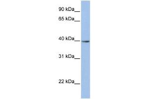 WB Suggested Anti-ZNF202 Antibody Titration:  0. (ZNF202 抗体  (N-Term))