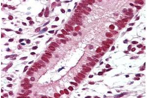 Anti-RXRB antibody IHC staining of human uterus. (Retinoid X Receptor beta 抗体  (Hinge Region))
