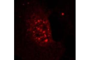 Image no. 3 for anti-V-Akt Murine Thymoma Viral Oncogene Homolog 1 (AKT1) (pThr308) antibody (ABIN196710) (AKT1 抗体  (pThr308))