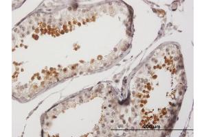 Immunoperoxidase of purified MaxPab antibody to SPA17 on formalin-fixed paraffin-embedded human testis. (SPA17 抗体  (AA 1-151))