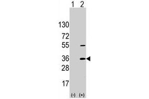 Western blot analysis of SSR1 (arrow) using SSR1 polyclonal antibody . (SSR1 抗体  (N-Term))