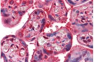 Human Placenta: Formalin-Fixed, Paraffin-Embedded (FFPE) (CLIC1 抗体  (AA 1-242))