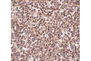 Immunohistochemistry of TREX1 in human spleen tissue with this product at 2. (TREX1 抗体  (Center))