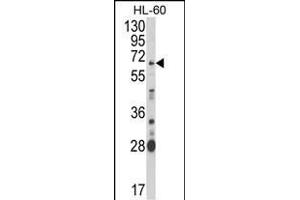 Western blot analysis of ARSB Antibody (Center) (ABIN652346 and ABIN2841582) in HL-60 cell line lysates (35 μg/lane). (Arylsulfatase B 抗体  (AA 235-266))