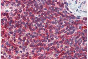 Immunohistochemistry (Formalin-fixed Paraffin-embedded Sections) (IHC (fp)) image for anti-Phosphatidylinositol-5-Phosphate 4-Kinase, Type II, alpha (PIP4K2A) (AA 304-366) antibody (ABIN790560)