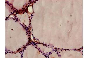 Immunohistochemistry of paraffin-embedded human thyroid tissue using ABIN7144296 at dilution of 1:100 (Annexin A9 抗体  (AA 8-345))