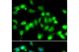 Immunofluorescence analysis of HeLa cells using AKAP5 Polyclonal Antibody at dilution of 1:100. (AKAP5 抗体)