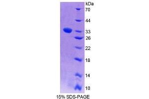 SDS-PAGE analysis of Mouse PCYOX1 Protein. (PCYOX1 蛋白)