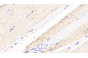 Detection of NMU in Rat Skeletal muscle Tissue using Polyclonal Antibody to Neuromedin U (NMU) (Neuromedin U 抗体  (AA 38-174))