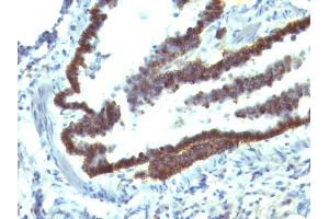 Formalin-fixed, paraffin-embedded Rat Lung stained with EpCAM Mouse Monoclonal Antibody (EGP40/1110).