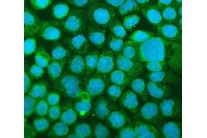 IF analysis of ICAM1 using anti-ICAM1 antibody (ABIN5692991). (ICAM1 抗体  (AA 28-268))