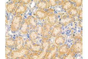 ABIN6258273 and ABIN6274214 at 1/100 staining Rat lung tissue by IHC-P.
