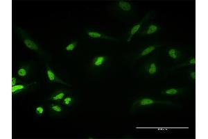 Immunofluorescence of purified MaxPab antibody to PKNOX1 on HeLa cell. (PKNOX1 抗体  (AA 1-436))