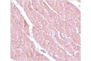 Immunohistochemistry of ATG13 in mouse heart with ATG13 antibody at 5 μg/ml. (ATG13 抗体  (C-Term))