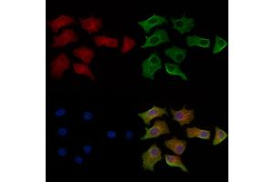 ABIN6264247 and ABIN6269325 staining HepG2 cells by IF/ICC.