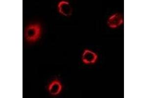 Immunofluorescent analysis of BRCC2 staining in MCF7 cells. (BRCA2 抗体)